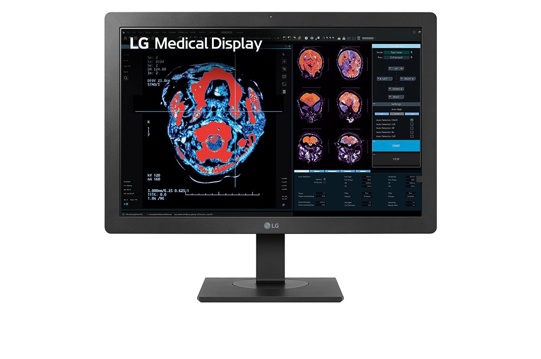 Professional Monitors Diagnostic Range
